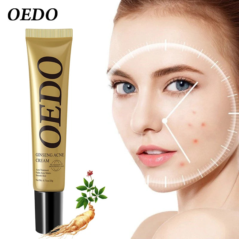 Plant Extraction Repair Acne Cream Ginseng Scutellariae Extract Face Care Acne Treatment Skin Care Facial Cream Whitening 20g