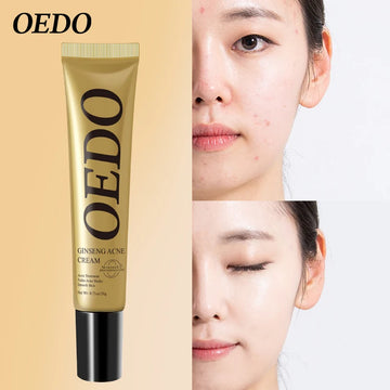 Plant Extraction Repair Acne Cream Ginseng Scutellariae Extract Face Care Acne Treatment Skin Care Facial Cream Whitening 20g